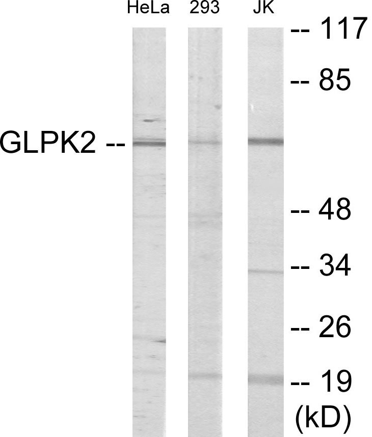 GK2 Cell Based ELISA Kit