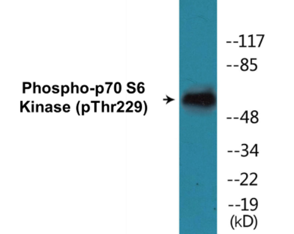 p70 S6 Kinase (phospho Thr229) Cell Based ELISA Kit