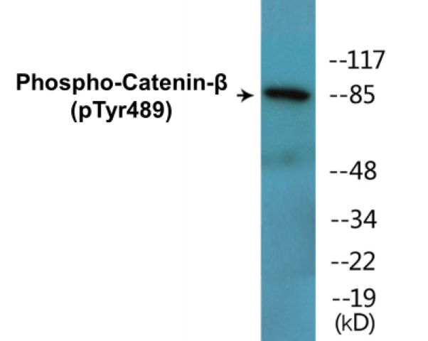 beta Catenin (phospho Tyr489) Cell Based ELISA Kit