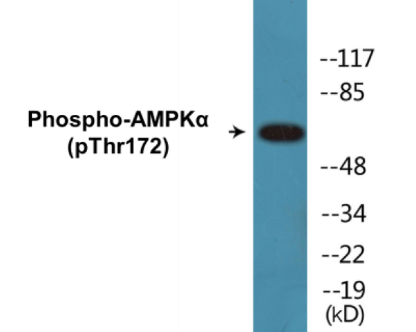 AMPK alpha (phospho Thr172) Cell Based ELISA Kit
