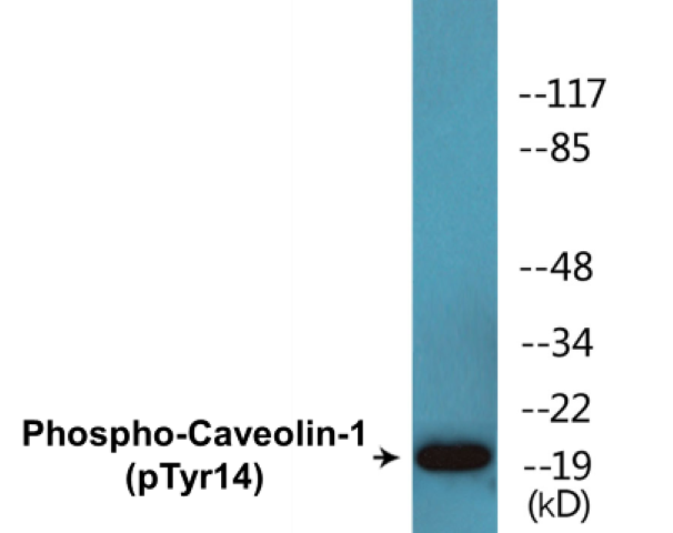 Caveolin 1 (phospho Tyr14) Cell Based ELISA Kit