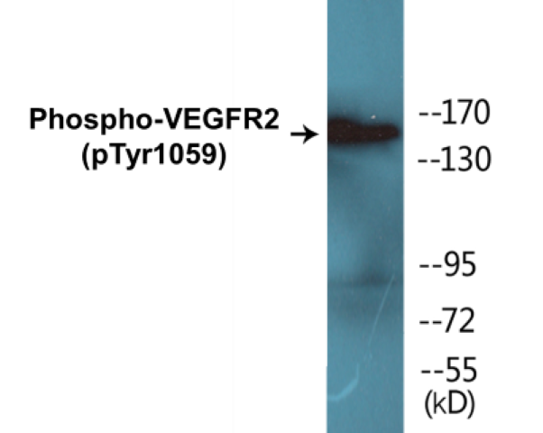 VEGFR2 (phospho Tyr1059) Cell Based ELISA Kit