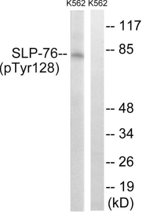 SLP-76 (phospho Tyr128) Cell Based ELISA Kit