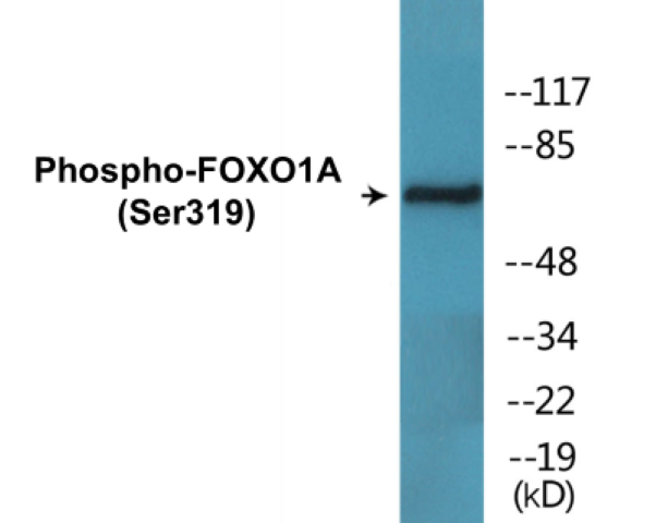 FOXO1A (phospho Ser319) Cell Based ELISA Kit