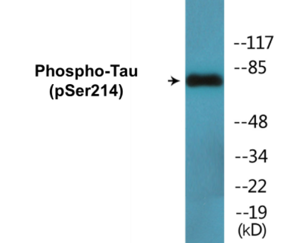 Tau (phospho Ser214) Cell Based ELISA Kit
