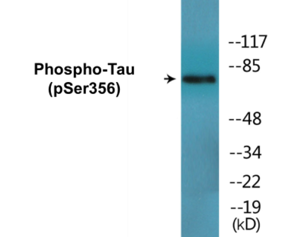 Tau (phospho Ser356) Cell Based ELISA Kit