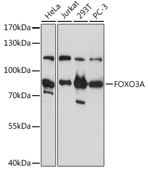 Anti-FOXO3A Antibody