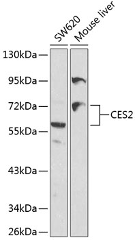Anti-CES2 Antibody