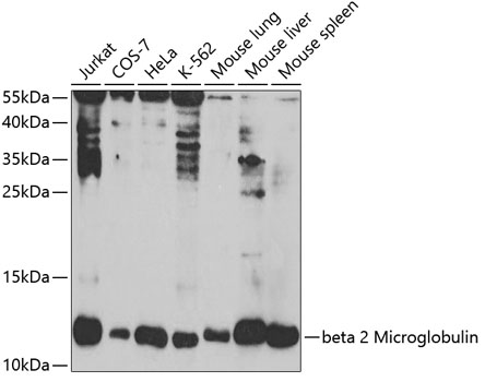 Anti-beta 2 Microglobulin Antibody - Identical to Abcam (ab175031)