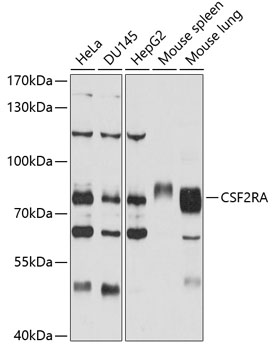 Anti-CD116 Antibody