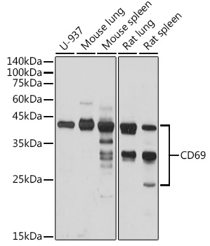 Anti-CD69 Antibody