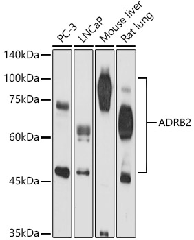 Anti-beta 2 Adrenergic Receptor Antibody