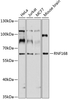 Anti-RNF168 Antibody