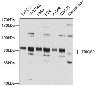 Anti-TRIOBP Antibody