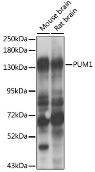 Anti-PUM1 Antibody