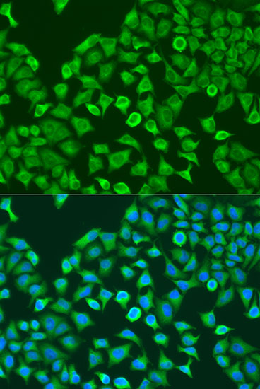 Anti-PUM1 Antibody Anti-PUM1 Antibody