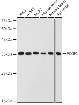 Anti-PCGF1 Antibody