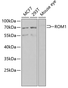 Anti-ROM1 Antibody