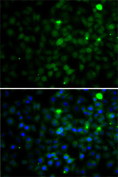 Anti-SMYD4 Antibody Anti-SMYD4 Antibody
