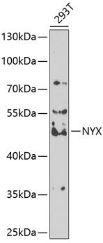 Anti-Nyctalopin Antibody