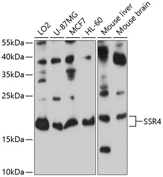 Anti-SSR4 Antibody