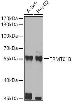 Anti-TRMT61B Antibody