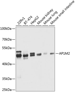Anti-AP1M2 Antibody