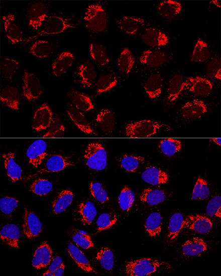 Anti-AP1M2 Antibody Anti-AP1M2 Antibody
