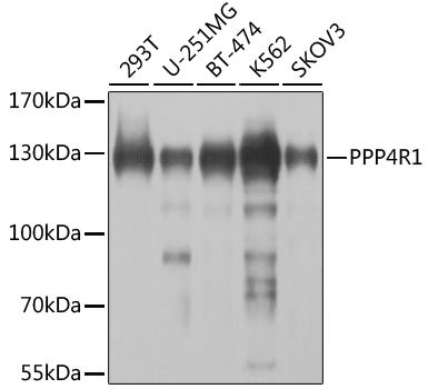 Anti-PPP4R1 Antibody