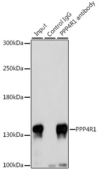 Anti-PPP4R1 Antibody Anti-PPP4R1 Antibody