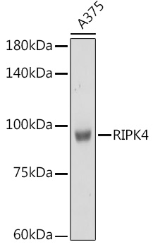 Anti-RIPK4 Antibody