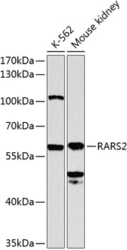 Anti-RARS2 Antibody
