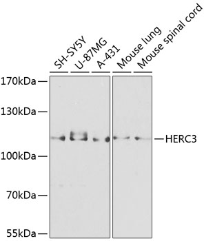Anti-HERC3 Antibody