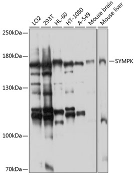 Anti-Symplekin Antibody