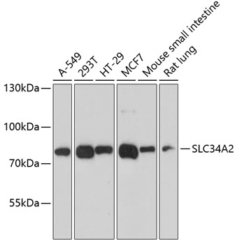 Anti-SLC34A2 Antibody