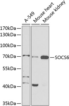 Anti-SOCS6 Antibody