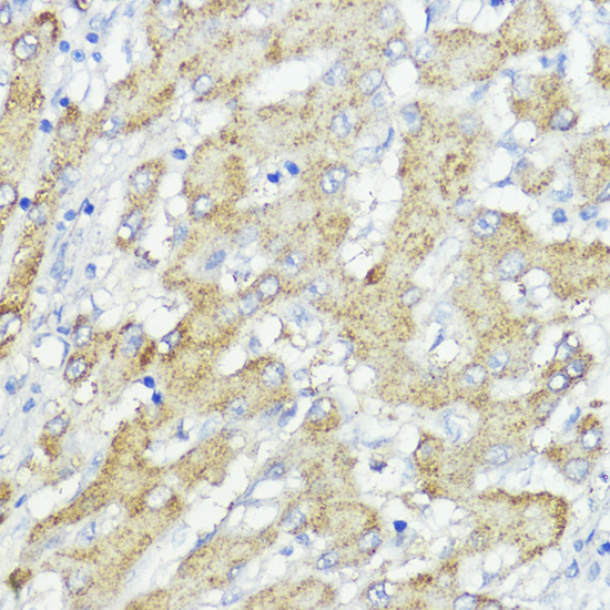 Anti-SOCS6 Antibody Anti-SOCS6 Antibody