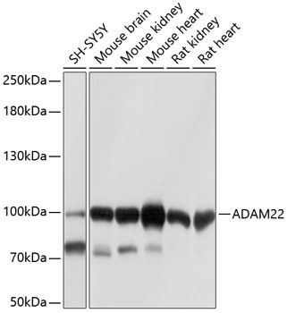 Anti-ADAM22 Antibody