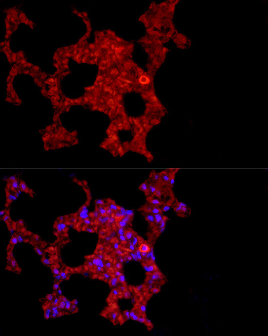 Anti-MARCO Antibody Anti-MARCO Antibody
