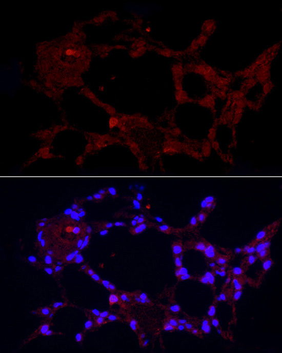 Anti-MARCO Antibody Anti-MARCO Antibody