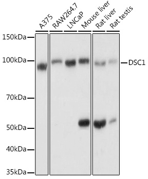 Anti-Desmocollin 1 Antibody