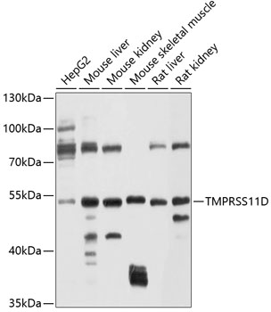 Anti-TMPRSS11D Antibody