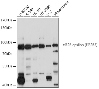 Anti-EIF2B5 Antibody