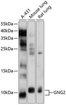 Anti-GNG2 Antibody