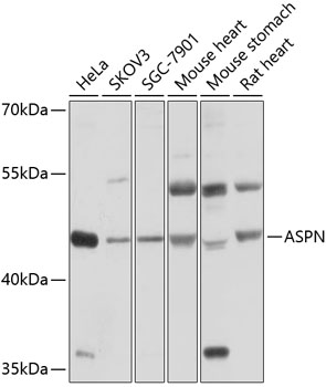 Anti-Asporin Antibody