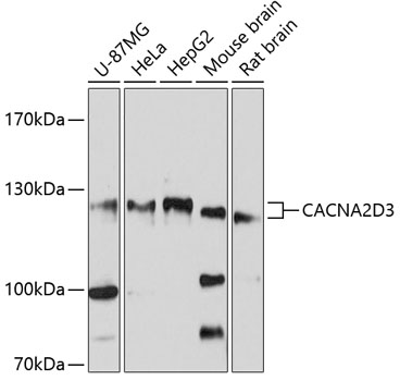 Anti-CACNA2D3 Antibody