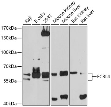 Anti-FCRL4 Antibody