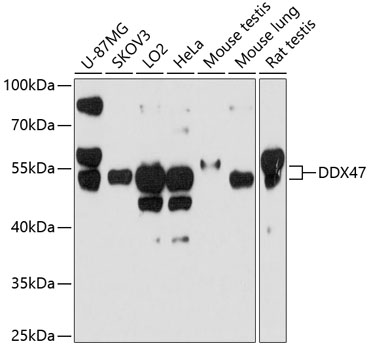 Anti-DDX47 Antibody