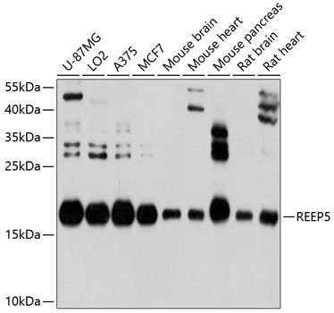 Anti-REEP5 Antibody