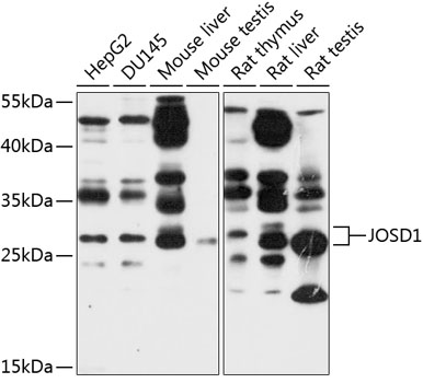 Anti-JOSD1 Antibody
